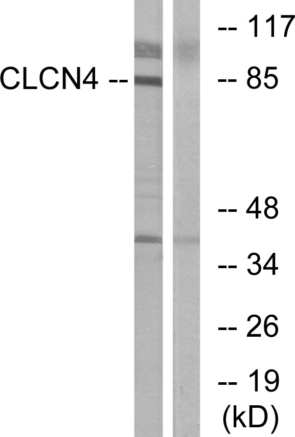 CLCN4 / CLC-4 Antibody - Western blot analysis of lysates from MCF-7 cells, using CLCN4 Antibody. The lane on the right is blocked with the synthesized peptide.