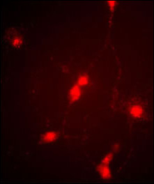 CLCN4 / CLC-4 Antibody - Immunofluorescence image of cultured chick retinal amacrine (neuronal) cells labeled with CLC4 Antibody. Data courtesy of Emily McMains, Louisiana State University.