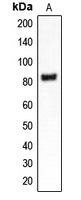 CLCN4 / CLC-4 Antibody - Western blot analysis of CLCN4 expression in MDAMB453 (A) whole cell lysates.