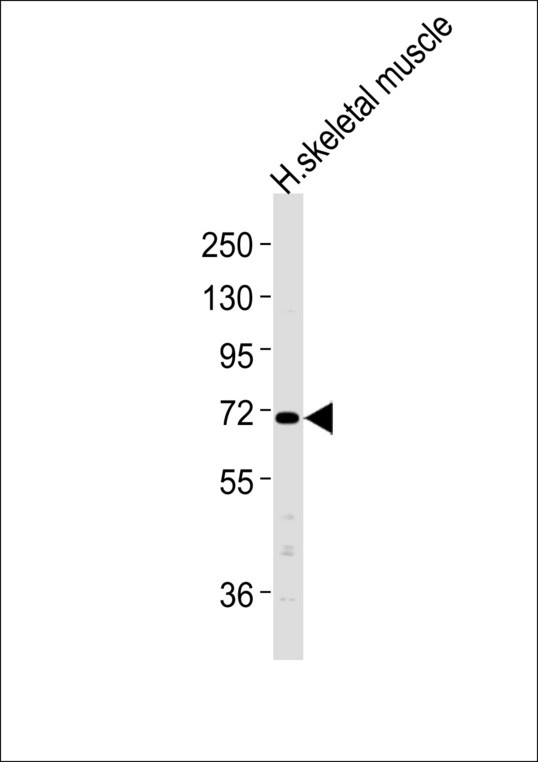 CLCN4 / CLC-4 Antibody - Anti-CHML Antibody at 1:1000 dilution + H.skeletal muscle tissue lysates Lysates/proteins at 20 ug per lane. Secondary Goat Anti-Rabbit IgG, (H+L),Peroxidase conjugated at 1/10000 dilution Predicted band size : 74 kDa Blocking/Dilution buffer: 5% NFDM/TBST.