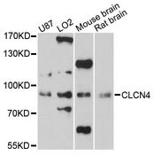 CLCN4 / CLC-4 Antibody - Western blot analysis of extracts of various cell lines, using CLCN4 antibody at 1:3000 dilution. The secondary antibody used was an HRP Goat Anti-Rabbit IgG (H+L) at 1:10000 dilution. Lysates were loaded 25ug per lane and 3% nonfat dry milk in TBST was used for blocking. An ECL Kit was used for detection and the exposure time was 60s.