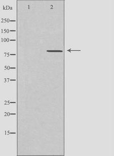 CLCN4 / CLC-4 Antibody - Western blot analysis of extracts of MCF-7 cells using CLCN4 antibody. The lane on the left is treated with the antigen-specific peptide.