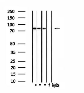 CLCN4 / CLC-4 Antibody - Western blot analysis of extracts of mouse brain and 293 cells and mouse lung using CLCN4 antibody.