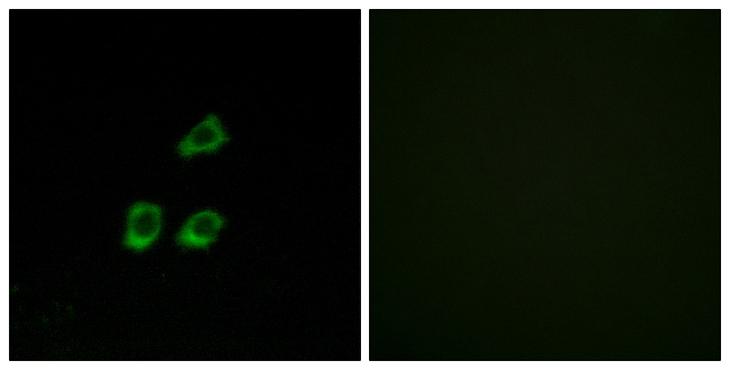 CLCN4 / CLC-4 Antibody - Peptide - + Immunofluorescence analysis of HUVEC cells, using CLCN4 antibody.