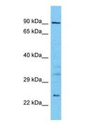 CLCN4 / CLC-4 Antibody - Western blot of CLCN4 Antibody with human 721_B Whole Cell lysate.  This image was taken for the unconjugated form of this product. Other forms have not been tested.