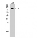 CLCN6 Antibody - Western blot of CLC-6 antibody