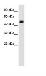 CLCN6 Antibody - Jurkat Cell Lysate.  This image was taken for the unconjugated form of this product. Other forms have not been tested.