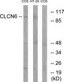 CLCN6 Antibody - Western blot analysis of lysates from COS7 and HT-29 cells, using CLCN6 Antibody. The lane on the right is blocked with the synthesized peptide.