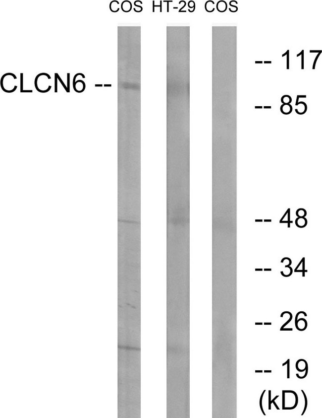 CLCN6 Antibody - Western blot analysis of lysates from COS7 and HT-29 cells, using CLCN6 Antibody. The lane on the right is blocked with the synthesized peptide.