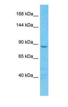 CLCN6 Antibody - Western blot of CLCN6 Antibody with human Jurkat Whole Cell lysate.  This image was taken for the unconjugated form of this product. Other forms have not been tested.