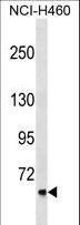 CLCNKA Antibody - CLCNKA Antibody western blot of NCI-H460 cell line lysates (35 ug/lane). The CLCNKA antibody detected the CLCNKA protein (arrow).