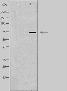 CLCNKA Antibody - Western blot analysis of extracts of HuvEc cells using CLCNKA antibody. The lane on the left is treated with the antigen-specific peptide.