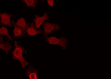 CLCNKA Antibody - Staining HuvEc cells by IF/ICC. The samples were fixed with PFA and permeabilized in 0.1% Triton X-100, then blocked in 10% serum for 45 min at 25°C. The primary antibody was diluted at 1:200 and incubated with the sample for 1 hour at 37°C. An Alexa Fluor 594 conjugated goat anti-rabbit IgG (H+L) Ab, diluted at 1/600, was used as the secondary antibody.