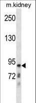 CLCNKB Antibody - CLCNKB Antibody western blot of mouse kidney tissue lysates (35 ug/lane). The CLCNKB antibody detected the CLCNKB protein (arrow).