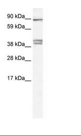 CLCNKB Antibody - Kidney Lysate.  This image was taken for the unconjugated form of this product. Other forms have not been tested.