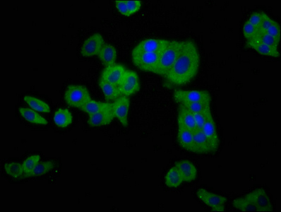 CLCNKB Antibody - Immunofluorescence staining of HepG2 cells at a dilution of 1:100, counter-stained with DAPI. The cells were fixed in 4% formaldehyde, permeabilized using 0.2% Triton X-100 and blocked in 10% normal Goat Serum. The cells were then incubated with the antibody overnight at 4 °C.The secondary antibody was Alexa Fluor 488-congugated AffiniPure Goat Anti-Rabbit IgG (H+L) .