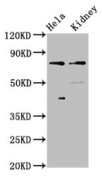 CLCNKB Antibody - Positive Western Blot detected in Hela whole cell lysate, Rat kidney tissue. All lanes: CLCNKB antibody at 3 µg/ml Secondary Goat polyclonal to rabbit IgG at 1/50000 dilution. Predicted band size: 76, 57 KDa. Observed band size: 76 KDa