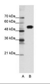 CLCNKB Antibody - A: Marker, B: Jurkat Cell Lysate.  This image was taken for the unconjugated form of this product. Other forms have not been tested.