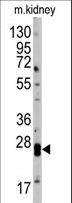 CLDN1 / Claudin 1 Antibody - Western blot of anti-hCLDN1-Loop2 antibody in mouse kidney tissue lysates (35 ug/lane). CLDN1(arrow) was detected using the purified antibody.