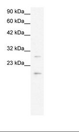 CLDN1 / Claudin 1 Antibody - HepG2 Cell Lysate.  This image was taken for the unconjugated form of this product. Other forms have not been tested.