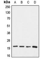 CLDN1 / Claudin 1 Antibody - Western blot analysis of Claudin 1 expression in HeLa (A); HepG2 (B); mouse kidney (C); rat kidney (D) whole cell lysates.