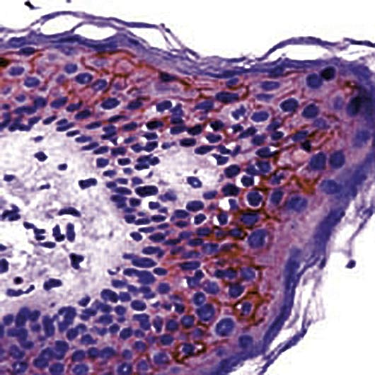 CLDN1 / Claudin 1 Antibody - Formalin-fixed, paraffin-embedded human skin stained with Claudin 1 antibody.