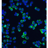 CLDN1 / Claudin 1 Antibody - Immunofluorescence of CLDN1 in HepG2 cells with CLDN1 antibody at 20 µg/mL.