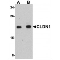 CLDN1 / Claudin 1 Antibody - Western blot analysis of CLDN1 in HepG2 cell lysate with CLDN1 antibody at (A) 1 and (B) 2 µg/mL.