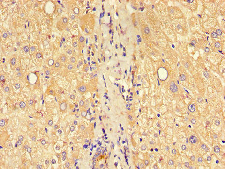 CLDN1 / Claudin 1 Antibody - Immunohistochemistry of paraffin-embedded human liver tissue using CLDN1 Antibody at dilution of 1:100