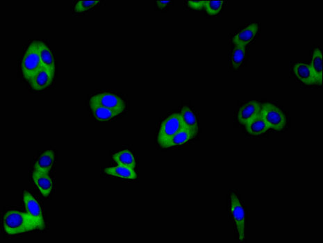 CLDN1 / Claudin 1 Antibody - Immunofluorescent analysis of HepG2 cells using CLDN1 Antibody at a dilution of 1:100 and Alexa Fluor 488-congugated AffiniPure Goat Anti-Rabbit IgG(H+L)
