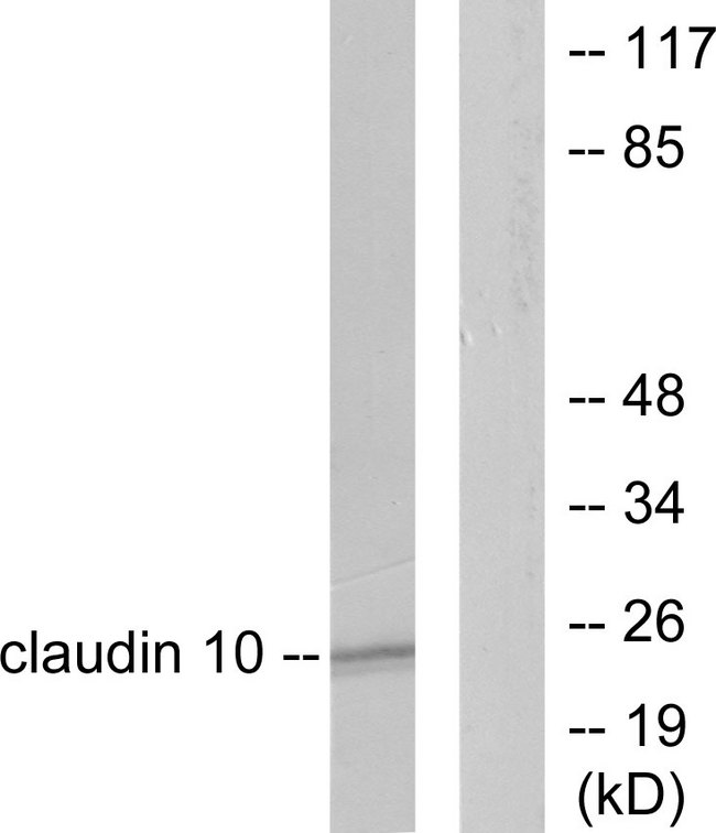 CLDN10 / Claudin 10 Antibody - Western blot analysis of lysates from LOVO cells, using Claudin 10 Antibody. The lane on the right is blocked with the synthesized peptide.