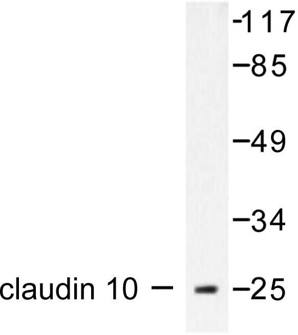 CLDN10 / Claudin 10 Antibody - Western blot of Claudin 10 (N217) pAb in extracts from LOVO.