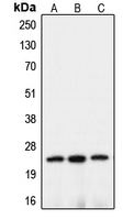 CLDN10 / Claudin 10 Antibody - Western blot analysis of Claudin 10 expression in HEK293T (A); mouse brain (B); rat kidney (C) whole cell lysates.