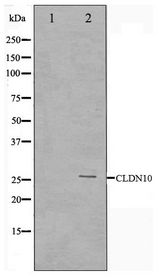 CLDN10 / Claudin 10 Antibody - Western blot of LOVO cell lysate using Claudin 10 Antibody