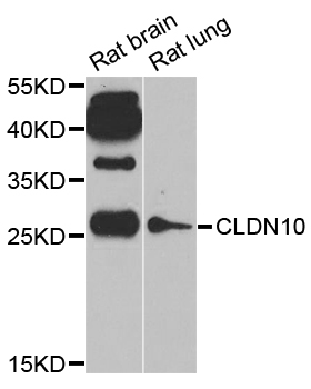 CLDN10 / Claudin 10 Antibody - Western blot analysis of extracts of various cell lines.