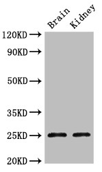 CLDN10 / Claudin 10 Antibody - Positive WB detected in:Mouse brain tissue,Mouse kidney tissue;All lanes:CLDN10 antibody at 2.4?g/ml;Secondary;Goat polyclonal to rabbit IgG at 1/50000 dilution;Predicted band size: 25,23 KDa;Observed band size: 25 KDa;