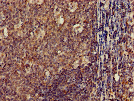 CLDN10 / Claudin 10 Antibody - Immunohistochemistry of paraffin-embedded human tonsil tissue using CLDN10 Antibody at dilution of 1:100