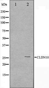 CLDN10 / Claudin 10 Antibody - Western blot analysis on LOVO cells cell lysates using Claudin 10 antibody. The lane on the left is treated with the antigen-specific peptide.