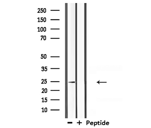 CLDN10 / Claudin 10 Antibody - Western blot analysis of extracts of 293 cells using Claudin 10 antibody.