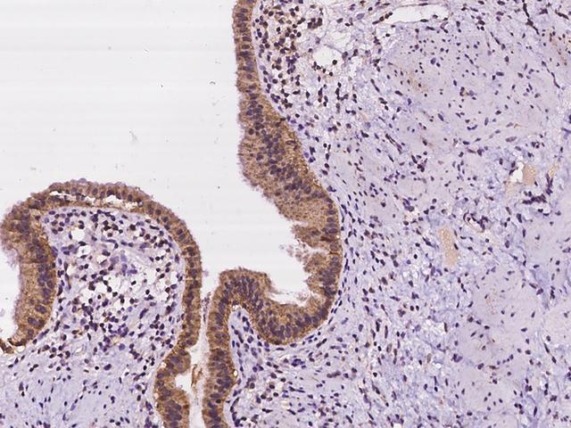 CLDN10 / Claudin 10 Antibody - Immunochemical staining of human CLDN10 in human gallbladder with rabbit polyclonal antibody at 1:100 dilution, formalin-fixed paraffin embedded sections.