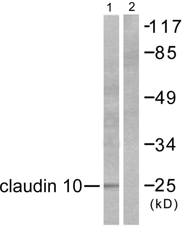 CLDN10 / Claudin 10 Antibody - Western blot analysis of extracts from LOVO cells, using Claudin 10 antibody.