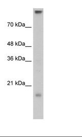 CLDN11 / Claudin 11 Antibody - Transfected 293T Cell Lysate.  This image was taken for the unconjugated form of this product. Other forms have not been tested.