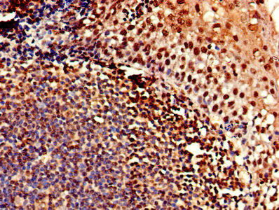 CLDN12 / Claudin 12 Antibody - Immunohistochemistry of paraffin-embedded human tonsil tissue using CLDN12 Antibody at dilution of 1:100