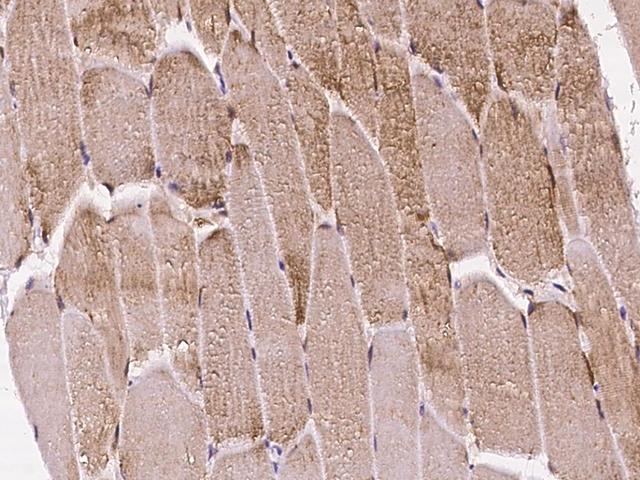 CLDN12 / Claudin 12 Antibody - Immunochemical staining of human CLDN12 in human skeletal muscle with rabbit polyclonal antibody at 1:100 dilution, formalin-fixed paraffin embedded sections.