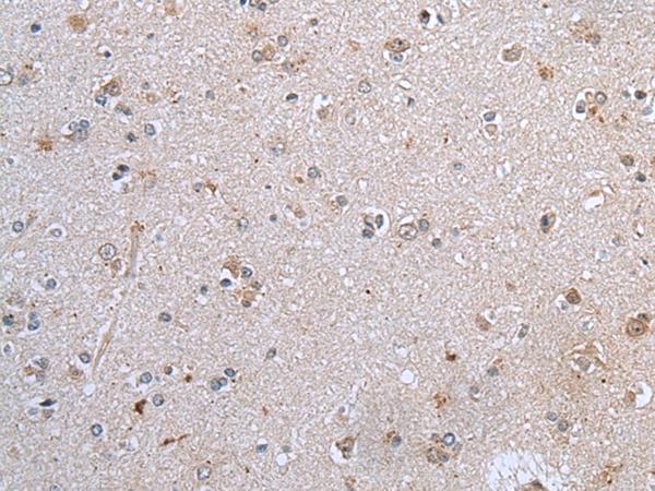 CLDN12 / Claudin 12 Antibody - Immunohistochemistry of paraffin-embedded Human brain tissue  using CLDN12 Polyclonal Antibody at dilution of 1:45(×200)