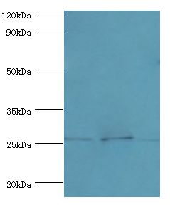 CLDN14 / Claudin 14 Antibody - Western blot. All lanes: Claudin-14 antibody at 4 ug/ml. Lane 1: rat liver tissue. Lane 2: mouse kidney tissue. Lane 3: HeLa whole cell lysate. Secondary antibody: Goat polyclonal to rabbit at 1:10000 dilution. Predicted band size: 26 kDa. Observed band size: 26 kDa Immunohistochemistry.