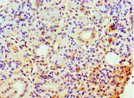 CLDN14 / Claudin 14 Antibody - Immunohistochemistry of paraffin-embedded human pancreas tissue using antibody at 1:100 dilution.
