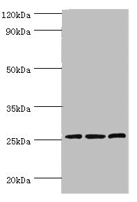 CLDN14 / Claudin 14 Antibody - Western blot All lanes: Claudin-14 antibody at 4µg/ml Lane 1: Rat liver tissue Lane 2: Mouse kidney tissue Lane 3: Hela whole cell lysate Secondary Goat polyclonal to rabbit IgG at 1/10000 dilution Predicted band size: 26 kDa Observed band size: 26 kDa