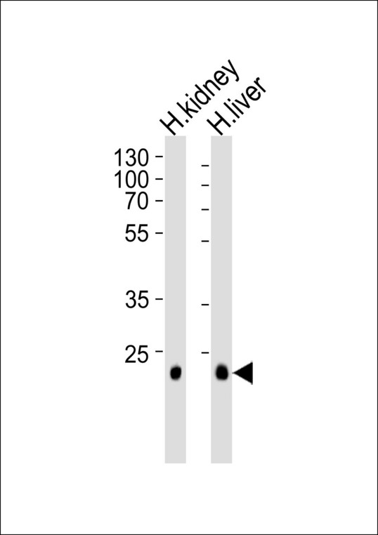 CLDN14 / Claudin 14 Antibody - Western blot of lysates from human kidney and liver tissue lysate (from left to right), using CLDN14 Antibody. Antibody was diluted at 1:1000 at each lane. A goat anti-rabbit IgG H&L (HRP) at 1:5000 dilution was used as the secondary antibody. Lysates at 35ug per lane.