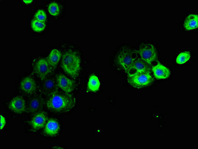 CLDN15 / Claudin 15 Antibody - Immunofluorescent analysis of A431 cells using CLDN15 Antibody at dilution of 1:100 and Alexa Fluor 488-congugated AffiniPure Goat Anti-Rabbit IgG(H+L)